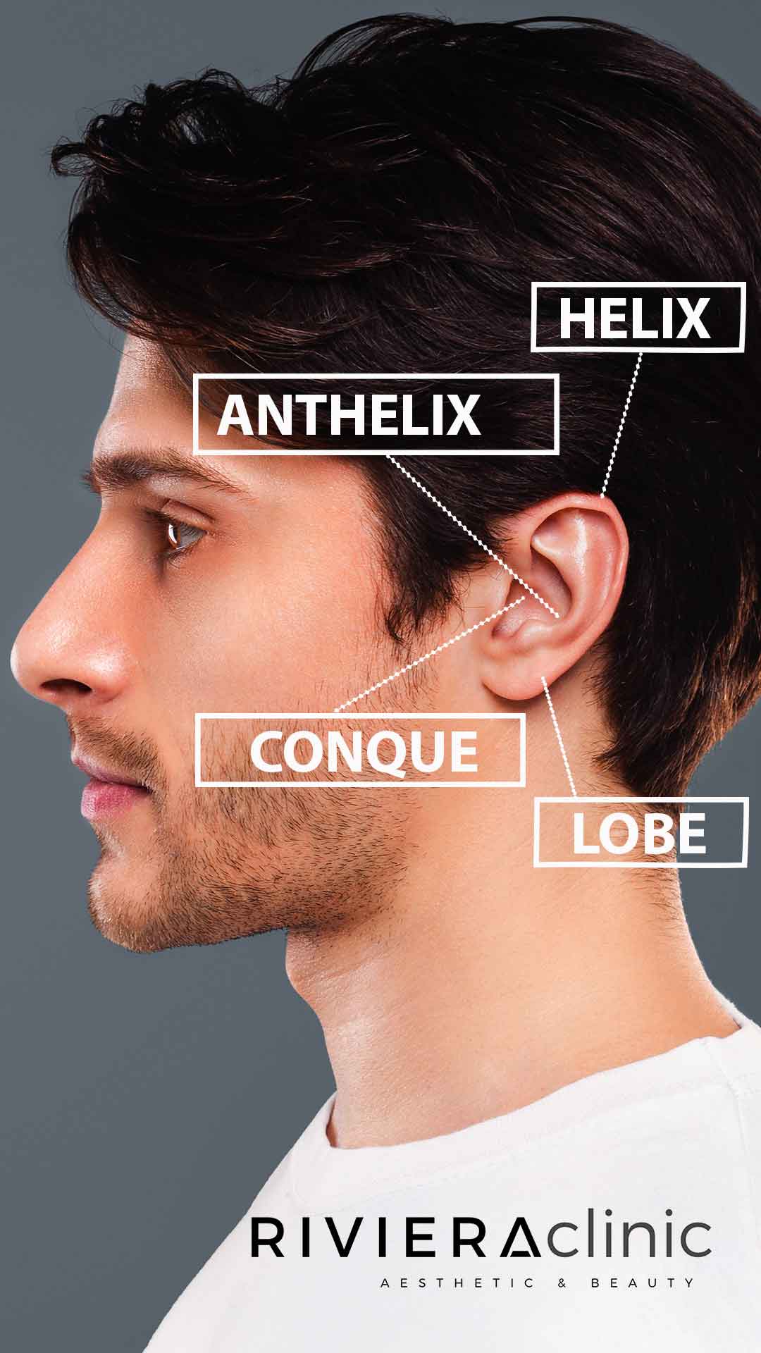 Comprendre l'anatomie de l'oreille pour une otoplastie, chirurgie des oreilles